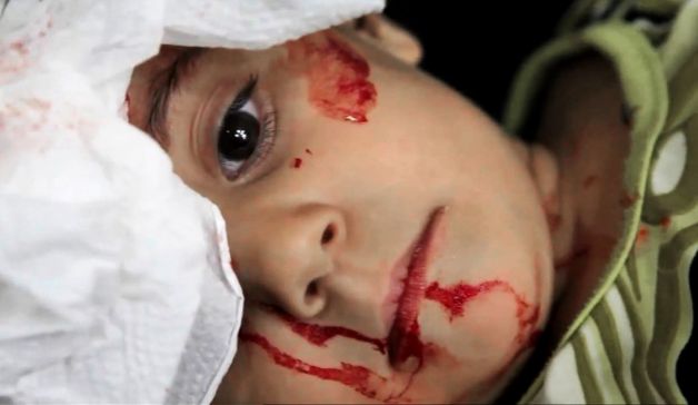 ÇOCUKLAR: Suriyede En Çok Onlar Ölüyorlar! 5
