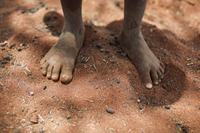 İHH kuraklık yaşanan Doğu Afrika için çalışma başlatıyor