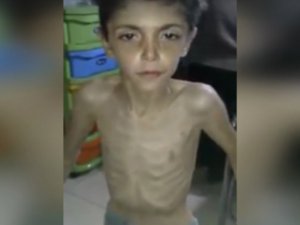 Madaya'daki Kardeşlerimizi Aç Bırakarak Öldürüyorlar!