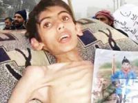 Suriye’nin Görülmeyen Diğer Madaya’ları